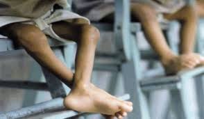 Mapani Venezuela / Informe Febrero – Marzo 2019: Desnutrición infantil de niños y niñas de 0 a 10 años